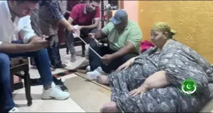 What Happened to This Woman After Surgery That Made Her Weight Reach 400 KG?